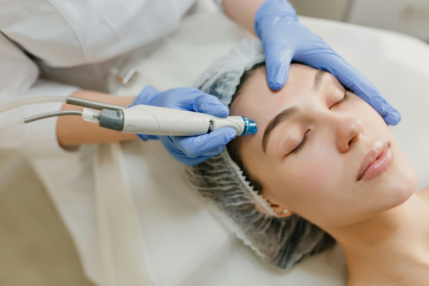 IPL Skin Rejuvenation